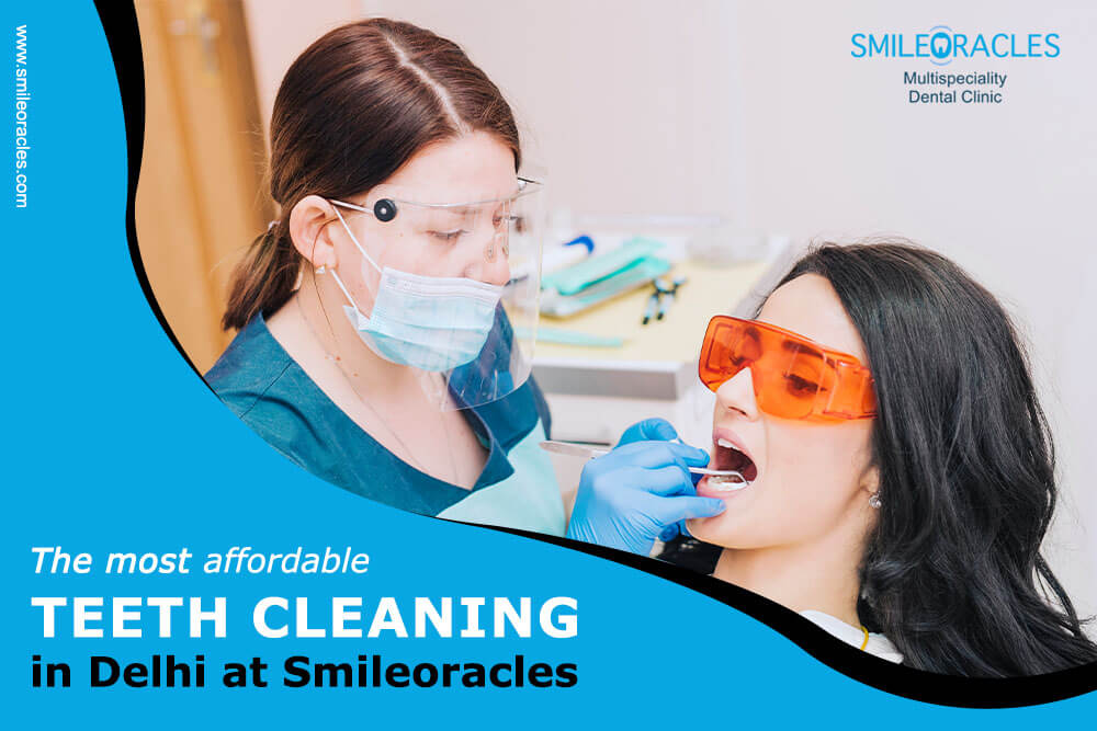 The Most Affordable Teeth Cleaning in Delhi at Smileoracles