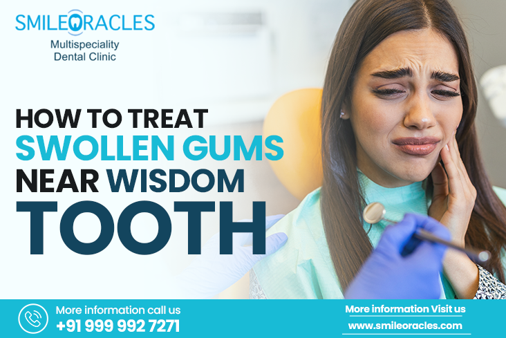 “Swollen gums around a partially erupted wisdom tooth”